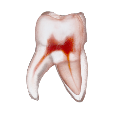 Orodeka Tooth Model Upper Molar B EACH