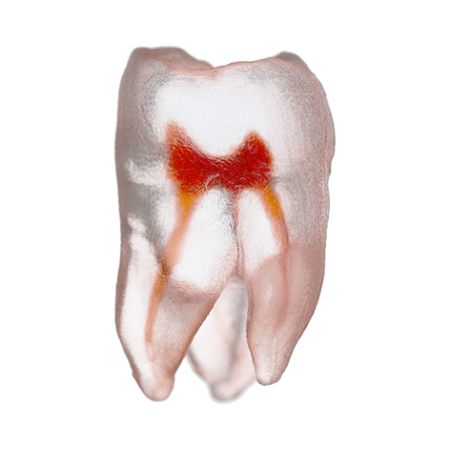 Orodeka Tooth Model Upper Molar A EACH