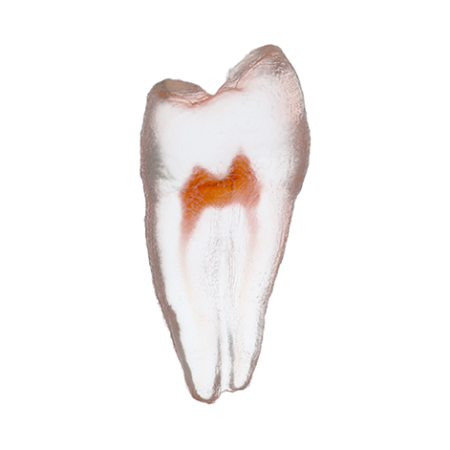Orodeka Tooth Model Premolar B EACH