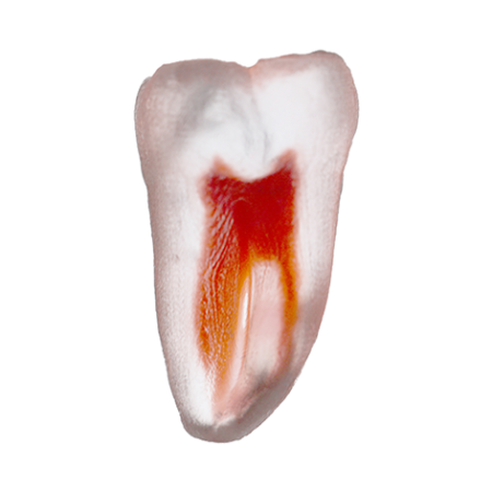 Orodeka Tooth Model Lower Molar C / Root Canal A EACH