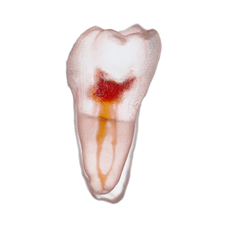 Orodeka Tooth Model Lower Molar B EACH