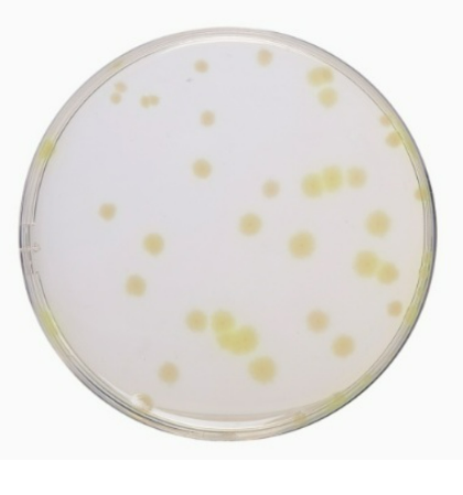 Ausmedia TSA Tryptic Soya Agar 10 plates/pack