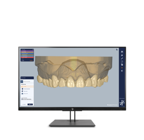 Ceramill Mind + Match 2 - CAD/CAM Software