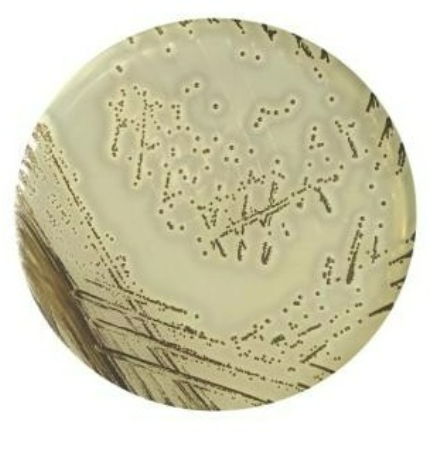 Ausmedia Baird Parker Agar plate 10 plates/pack