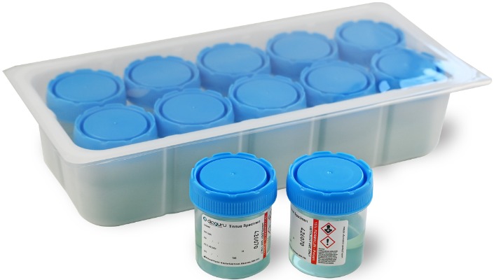 Diaguru 10% Neutral Buffered Formalin Jars 70ml Blue Tinted Tray/10, Box/100