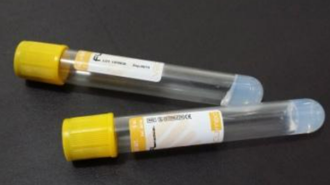 Vacumed with Gel Separator and Clot Activator, Golden-Yellow Cap, Sterile 16x100 mm, 8 ml of blood, Carton/600