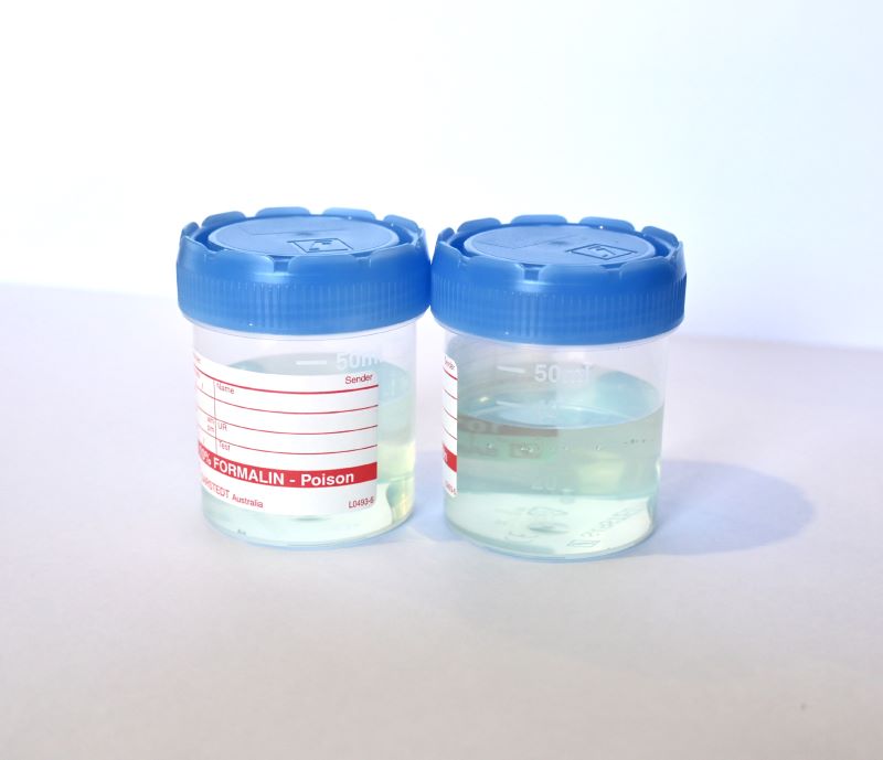 Neutral Buffered Formalin 70ml Jar Blue Tinted Box/100