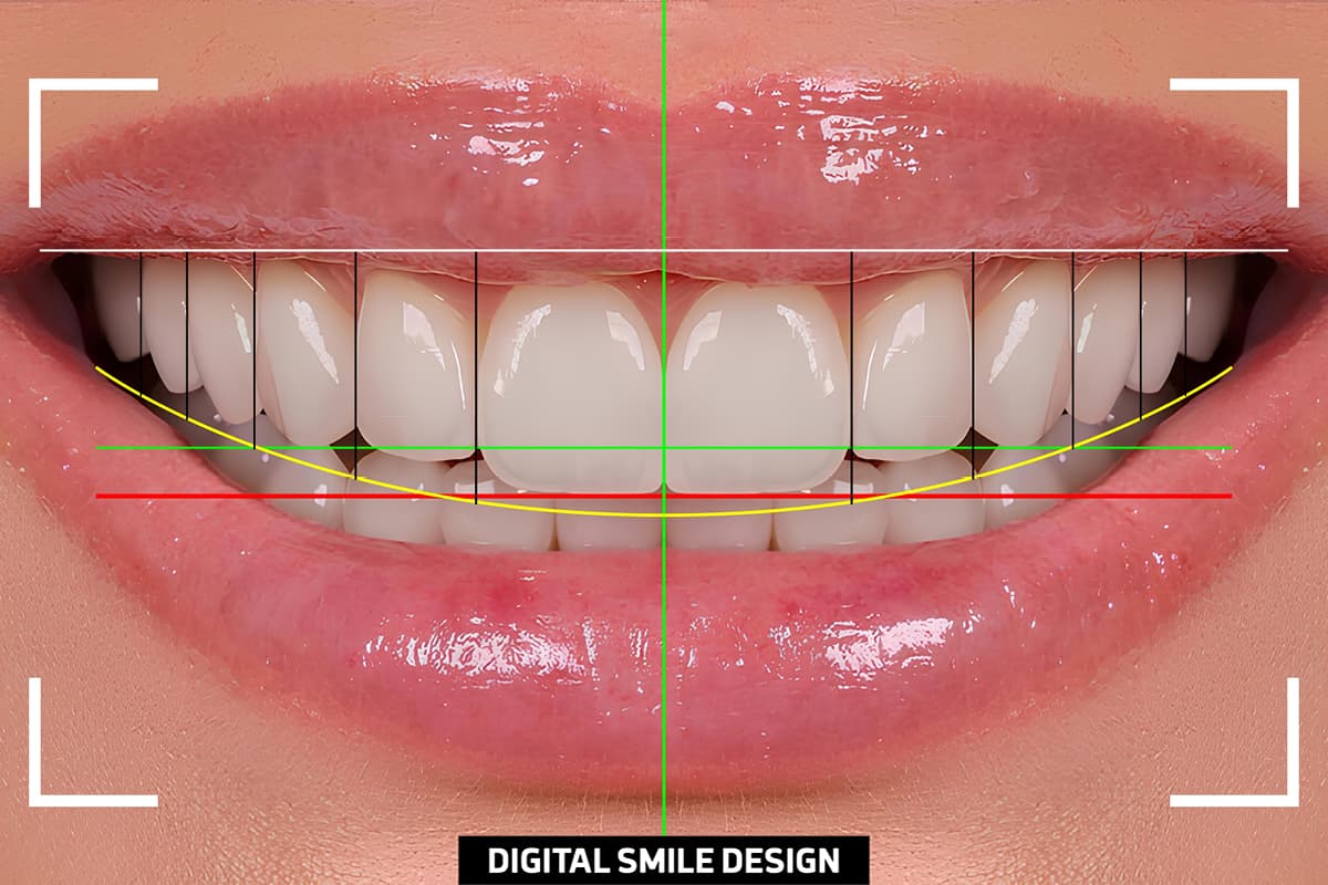 The role of digital technology in dentistry and dental aesthetics: advantages and limitations